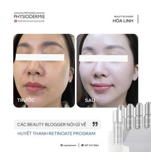 Lan da nhay cam cua Beauty Blogger Hoa Linh co dau hieu thay doi tich cuc