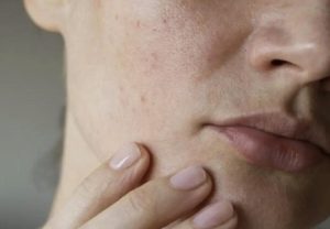 Lan da xin mau lo chan long to rat thich hop khi peel da tai nha Lan da xin mau lo chan long to rat thich hop khi peel da tai nha