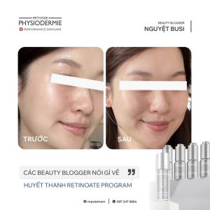 Sau 3 tuan dung Huyet thanh Retinoate Program lan da cua Beauty Blogger Nguyet Busi min mang hon han