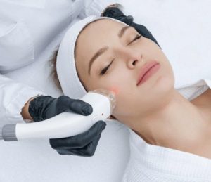 Gia tang hieu qua tre hoa da voi Huyet thanh Retinoate Program