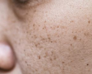 Lan da nam do lao hoa thuong xuat hien them tan nhang doi moi