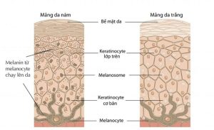 Nam ro co che hinh thanh nam da de tim duoc phuong phap dieu tri phu hop
