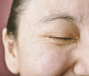 So sanh Adapalene va Retinol ve tinh hieu qua trong dieu tri da lao hoa