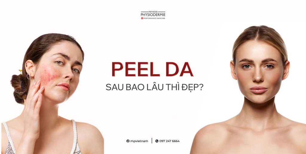 Peel da sau bao lâu thì đẹp? Cách chăm sóc da sau peel để đạt hiệu quả tối ưu 2 peel da sau bao lau thi dep