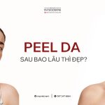 peel da sau bao lau thi dep