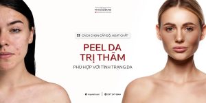 peel da tri tham duoc khong