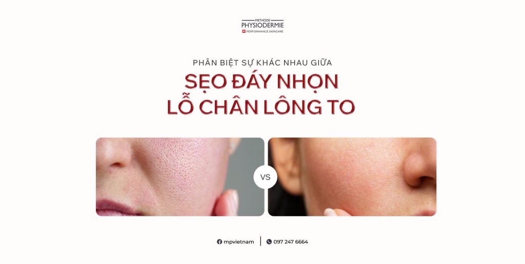 seo day nhon va lo chan long to