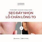 seo day nhon va lo chan long to