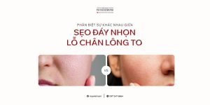 seo day nhon va lo chan long to