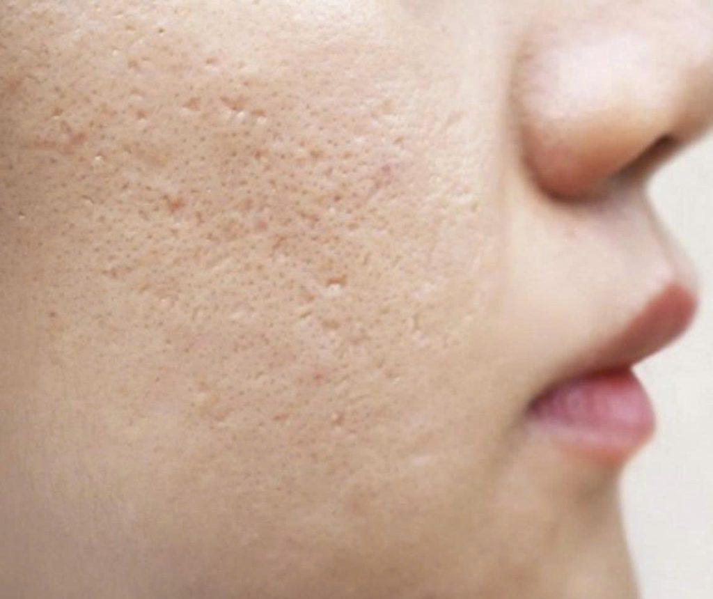 z7314525854657 2cd6f768accb0ef65b50dbb46a63c7f9 phan-biet-seo-day-nhon-va-lo-chan-long-to