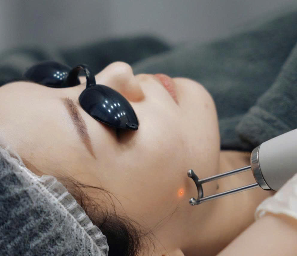 z7314525854667 aa2a4ae2e7af04d98f9dbeb2bb7d9f66 laser-hay-lan-kim-tri-seo-day-nhon