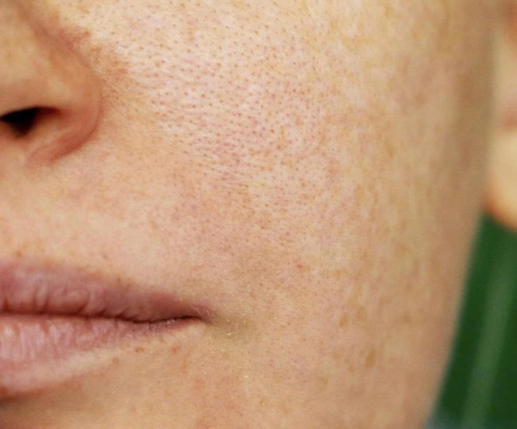 z7318011512046 009e80b31c53712aab4a288f222cfea0 da-mat-co-lo-chan-long-to