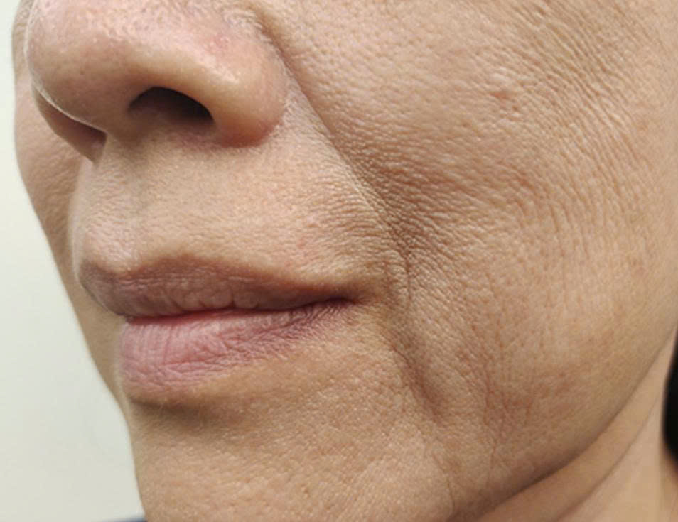 z7332631774095 381b9b24644cbe749b25f8bdafefab8c dau-hieu-da-kho-lao-hoa