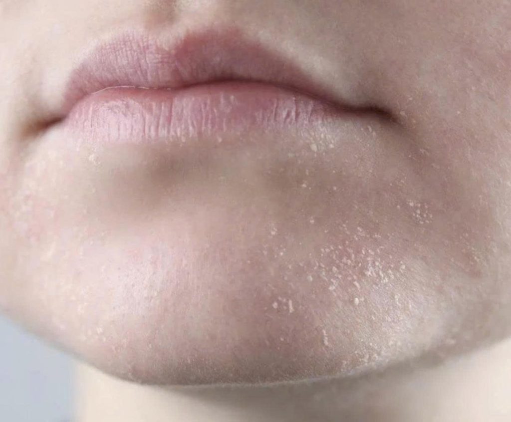 z7332631788042 0c896abbaa0bfeb5aa0f09198aa69cf0 da-kho-bong-troc