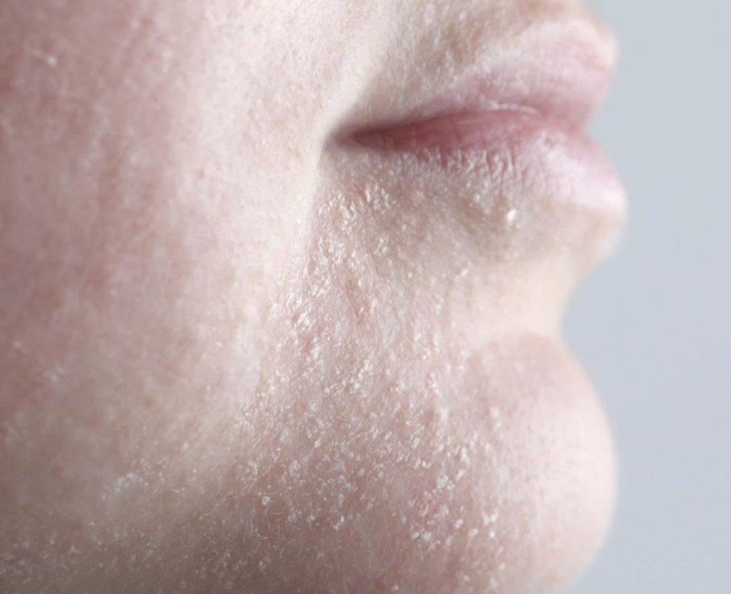 z7336532974899 c2eb19b7ff5c105132f4fbfc8f869b4b da-kho-bong-troc-do-thieu-am