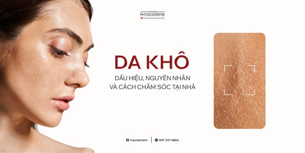 Da khô: Dấu hiệu, nguyên nhân và cách chăm sóc tại nhà 7 dau-hieu-nhan-biet-da-kho