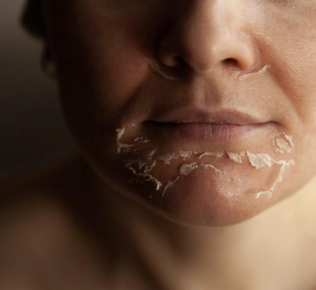 z7367267754223 569160b4e8fce923a53aa9b50642bd70 cac-cap-do-peel-da