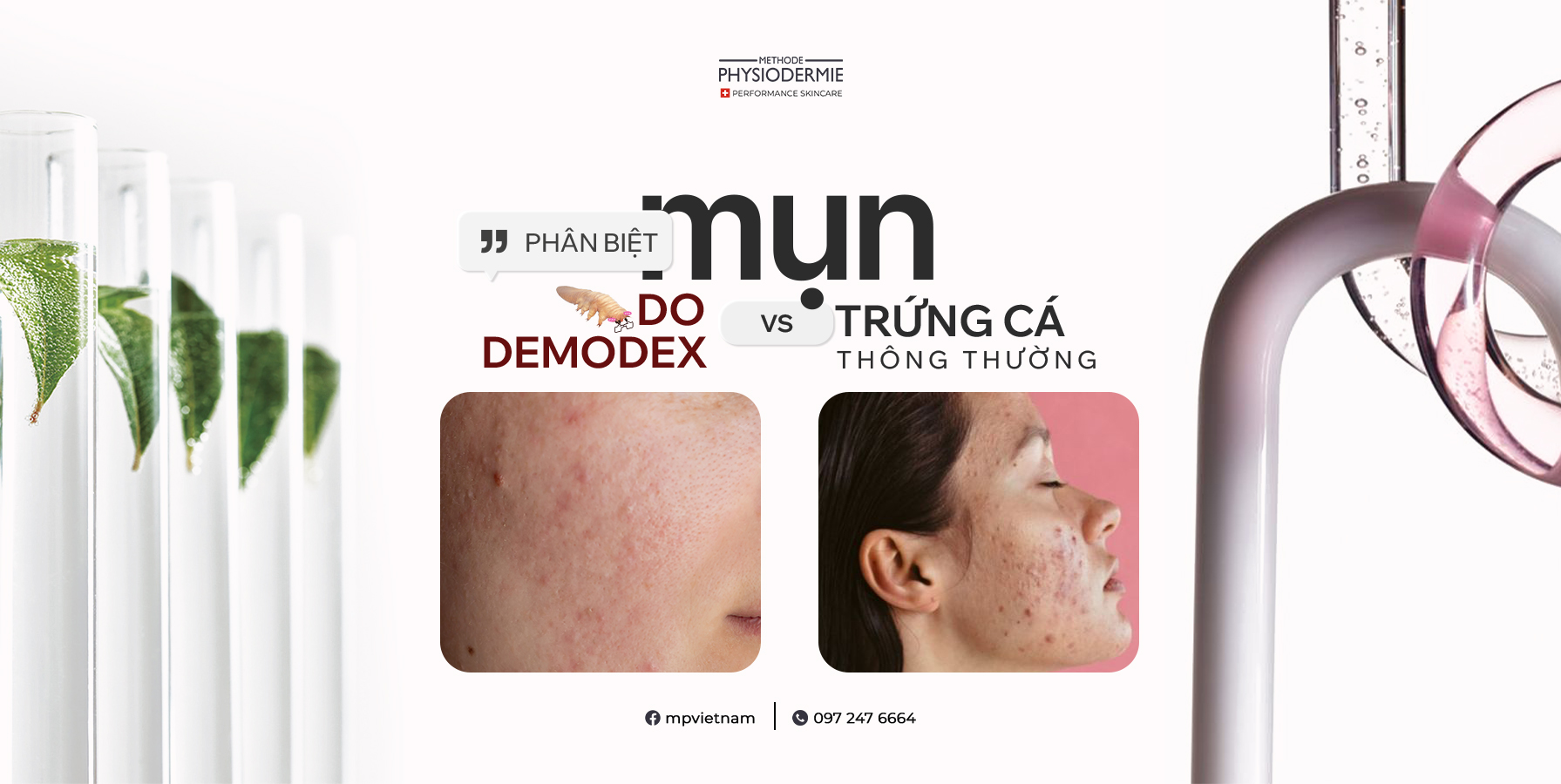 Phan-biet-mun-do-demodex-va-mun-trung-ca
