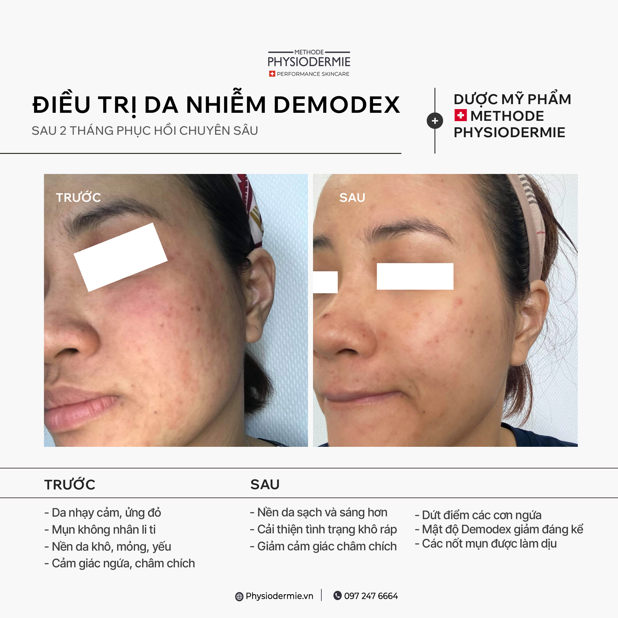 668868265 1462306845908079 1984137045771908045 n phac-do-cho-da-nhiem-demodex-tai-nha