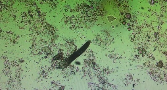 Hinh anh Demodex dang bo tren da duoi kinh hien vi 1 Hinh anh Demodex dang bo tren da duoi kinh hien vi 1