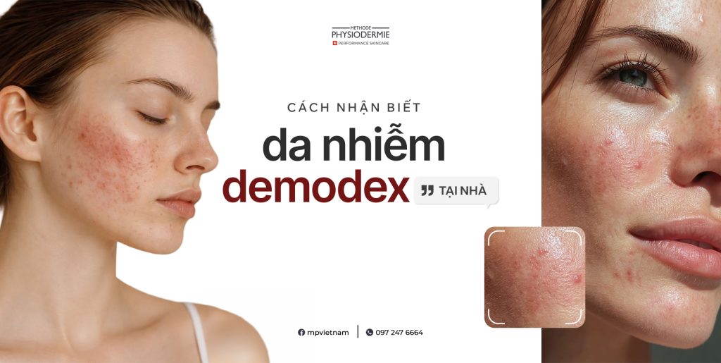 Cách nhận biết da nhiễm Demodex tại nhà 4 cach-nhan-biet-da-nhiem-demodex-tai-nha