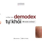 viem-da-demodex-co-tu-khoi-duoc-khong