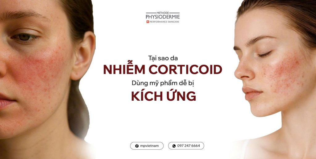 Tại sao da nhiễm Corticoid dùng mỹ phẩm dễ bị kích ứng? 2 tai-sao-da-nhiem-Corticoid-dung-my-pham-bi-kich-ung
