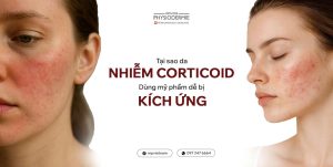 tai-sao-da-nhiem-Corticoid-dung-my-pham-bi-kich-ung