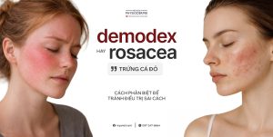 phan-biet-viem-da-Demodex-va-mun-trung-ca-do-Rosacea