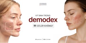 da-nhiem-Demodex-co-de-lay-khong
