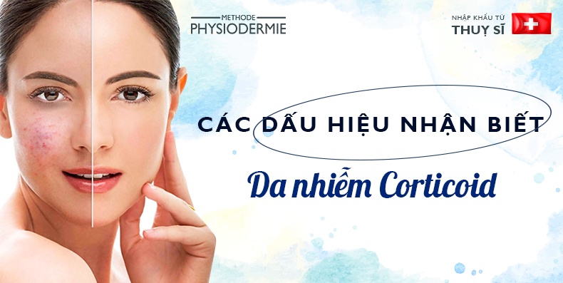 Dấu hiệu nhận biết da nhiễm Corticoid theo từng cấp độ dau-hieu-nhan-biet-da-nhiem-Corticoid