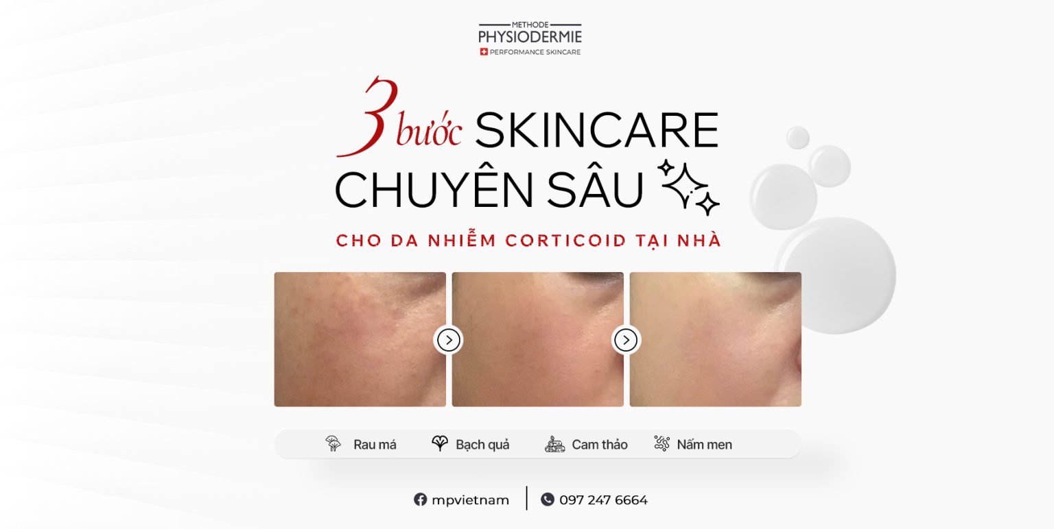 SEO 3 buoc cham soc da 2712 1536x772 Các bước chăm sóc da bị nhiễm Corticoid tại nhà