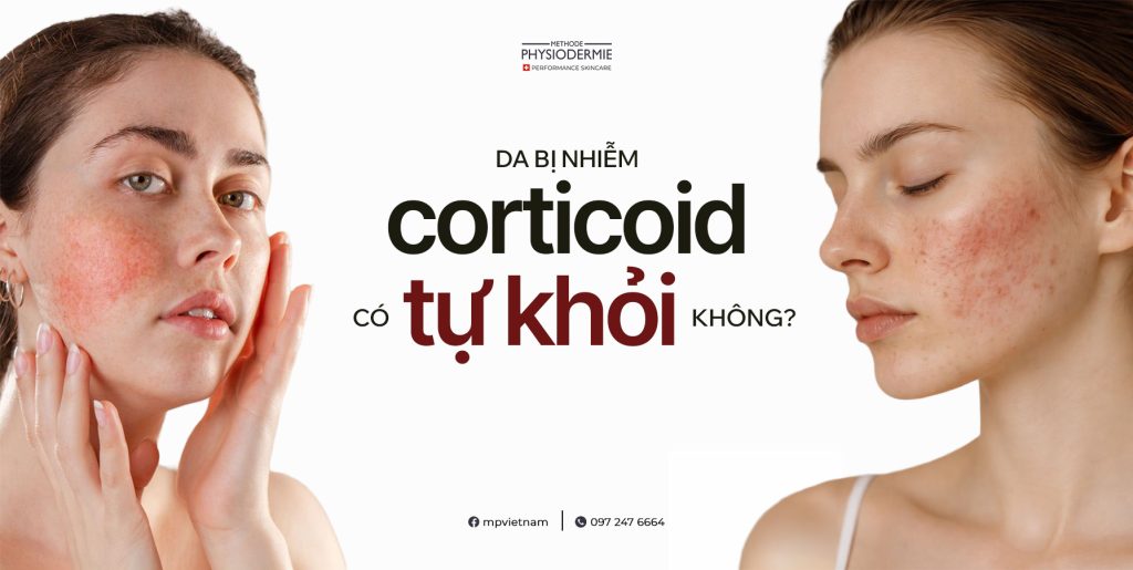 Da bị nhiễm Corticoid có tự khỏi không? 1 da bị nhiễm Corticoid có tự khỏi được không?