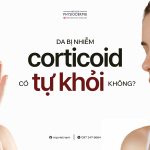 da bị nhiễm Corticoid có tự khỏi được không?