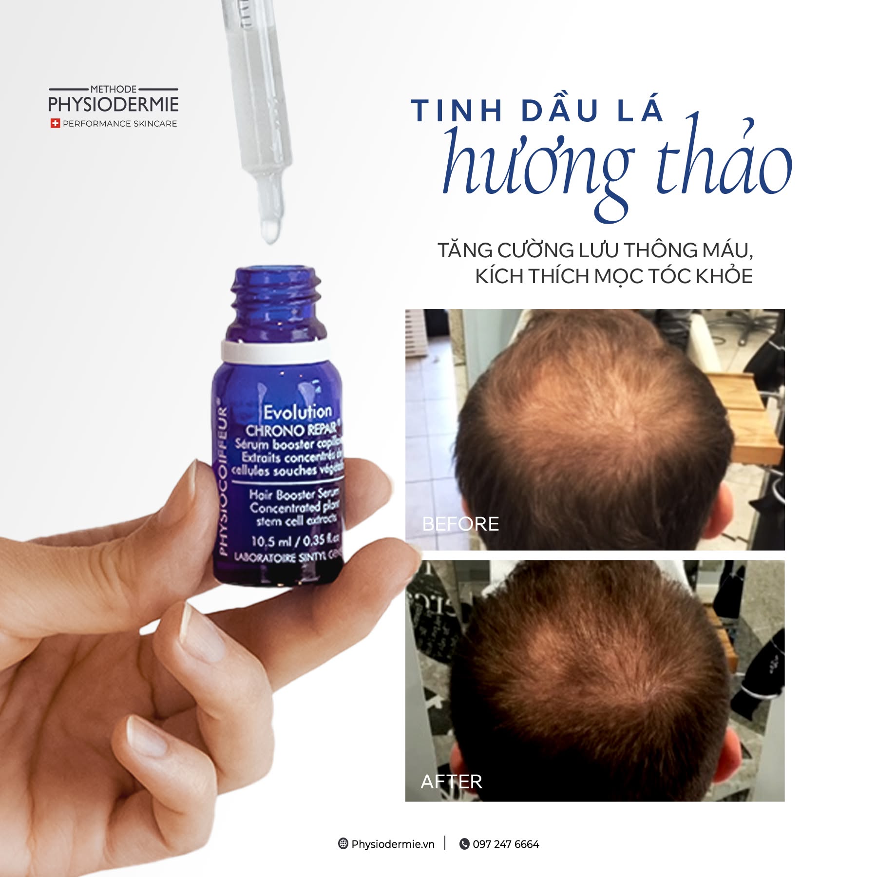 550503870 1291514282987337 5040591904593890313 n tinh chất tế bào gốc giảm rụng tóc, kích thích mọc tóc