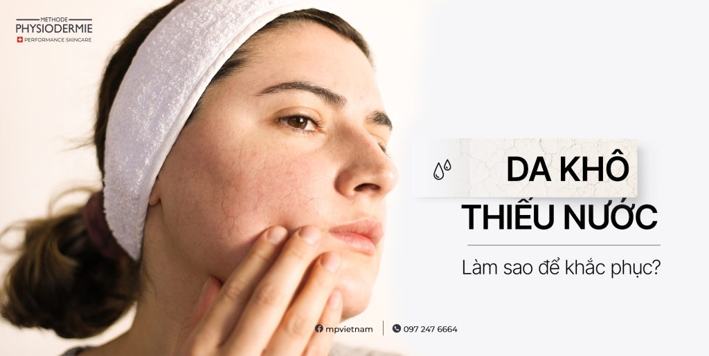 SEO Da kho thieu nuoc 1104 1024x515 cách cải thiện da mất nước