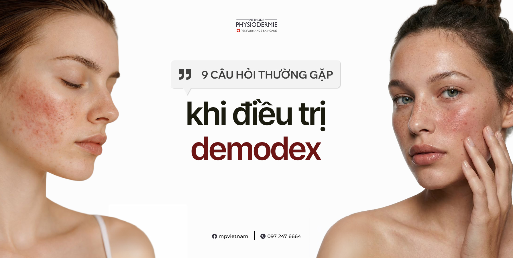 SEO Demodex 0708