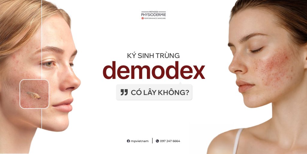 SEO Demodex 1206 1024x515 ký sinh trùng Demodex có khả năng lây nhiễm cao
