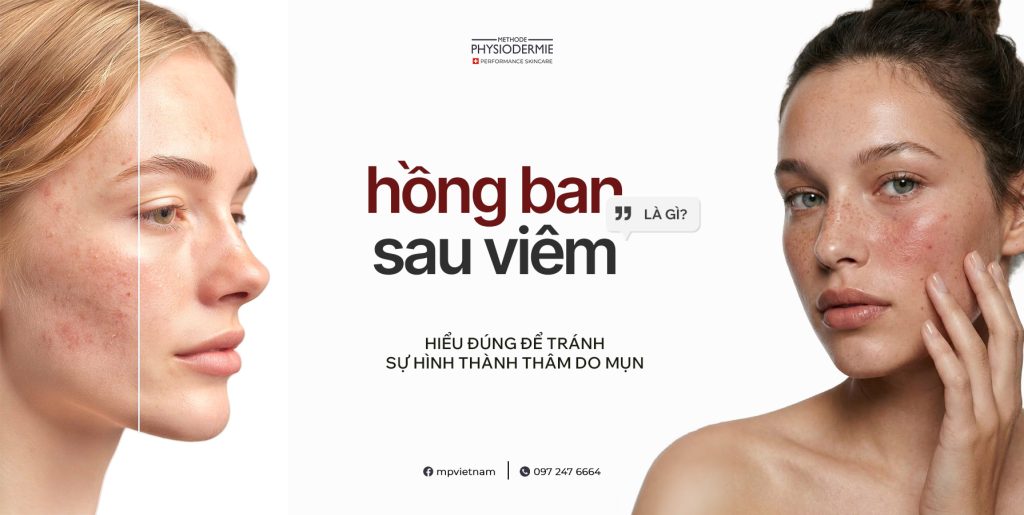 Hồng ban sau viêm là gì? Hiểu đúng để tránh sự hình thành thâm do mụn 1 hồng ban sau viêm là gì